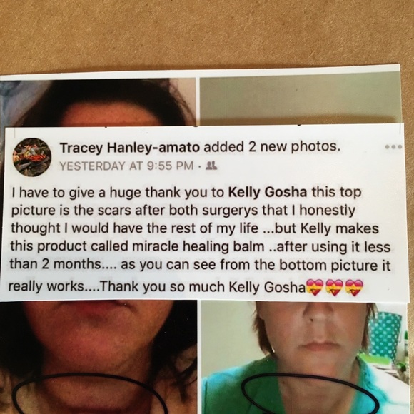 SUNDAY PM SALE!!❤️🩹MIRACLE HEALING BALM ❤️🛍🤗⭐️—BEST IN BEAUTY PICK!! 👌 - Picture 11 of 16